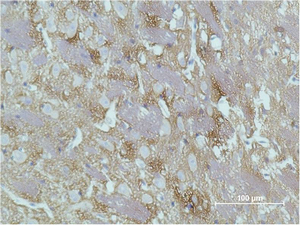 Immunohistochemistry of paraffin-embedded Rat brain tissue with GAP43 Monoclonal Antibody