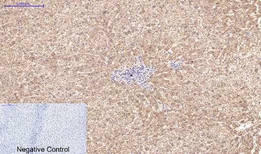 Immunohistochemistry of paraffin-embedded Human liver tissue using Active CASP3 Monoclonal Antibody at dilution of 1:200.