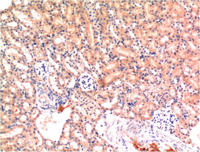 Immunohistochemistry of paraffin-embedded Mouse kidney tissue using Bax Monoclonal Antibody at dilution of 1:200.