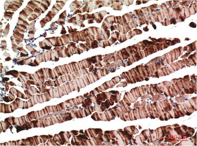 Immunohistochemistry of paraffin-embedded Mouse skeletal muscle tissue using ACTA1 Monoclonal Antibody at dilution of 1:200.