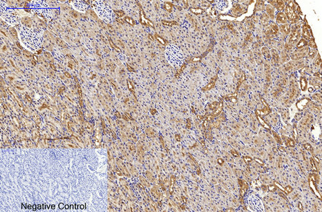 Immunohistochemistry of paraffin-embedded Rat kidney tissue using MAP1LC3A Monoclonal Antibody at dilution of 1:200.