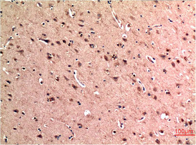 Immunohistochemistry of paraffin-embedded Human brain tissue using BECN1 Monoclonal Antibody at dilution of 1:200.