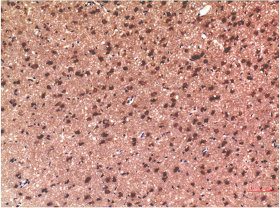 Immunohistochemistry of paraffin-embedded Rat brain tissue using Tau Polyclonal Antibody at dilution of 1:200.