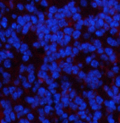 Immunofluorescence analysis of Mouse spleen tissue using PDGFRA Monoclonal Antibody at dilution of 1:200.