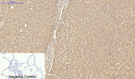 Immunohistochemistry of paraffin-embedded Human lung tissue using TTR Monoclonal Antibody at dilution of 1:200.