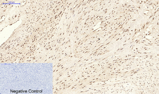 Immunohistochemistry of paraffin-embedded Human uterus tissue using CBX5 Monoclonal Antibody at dilution of 1:200.