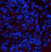 Immunofluorescence analysis of Rat spleen tissue using NBR1 Monoclonal Antibody at dilution of 1:200.