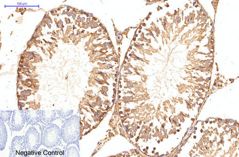 Immunohistochemistry of paraffin-embedded Rat testis tissue using ATG5 Monoclonal Antibody at dilution of 1:200.