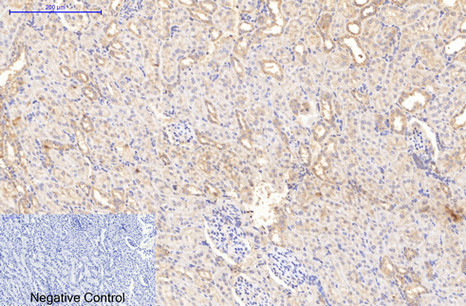 Immunohistochemistry of paraffin-embedded Rat kidney tissue using COL1A1 Monoclonal Antibody at dilution of 1:200.