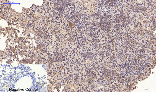 Immunohistochemistry of paraffin-embedded Mouse lung tissue using CD10 Monoclonal Antibody at dilution of 1:200.