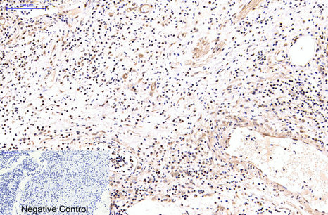 Immunohistochemistry of paraffin-embedded Human appendix tissue using NFκB-p65 Monoclonal Antibody at dilution of 1:200.