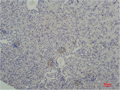 Immunohistochemistry of paraffin-embedded Mouse kidney tissue using TBP Monoclonal Antibody at dilution of 1:200.