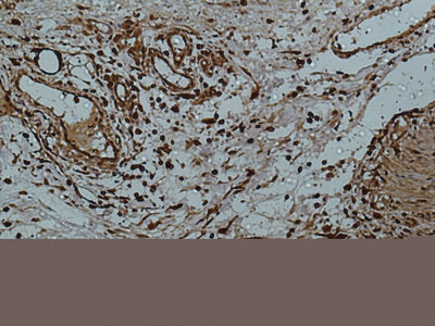 Immunohistochemistry of paraffin-embedded Human colon using Galectin 3 Monoclonal Antibody at dilution of 1:50.