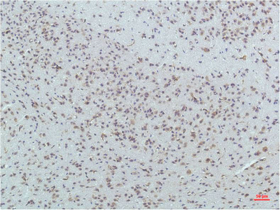 Immunohistochemistry of paraffin-embedded Mouse brain tissue using PPARD Monoclonal Antibody at dilution of 1:200.