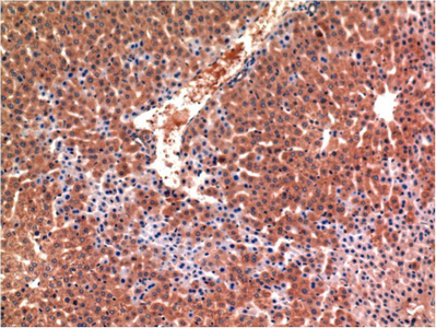 Immunohistochemistry of paraffin-embedded Mouse Liver tissue using CASP3 Monoclonal Antibody at dilution of 1:200.