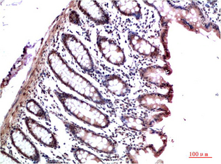 Immunohistochemistry of paraffin-embedded Human colon carcinoma tissue using CBX3 Monoclonal Antibody at dilution of 1:200.