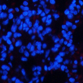 Immunofluorescence analysis of Rat lung tissue using Phospho-CHEK2 (Thr68) Polyclonal Antibody at dilution of 1:200