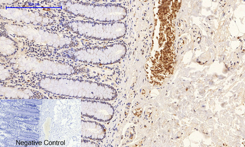 Immunohistochemistry of paraffin-embedded Human colon tissue with Phospho-p38 (Thr180/Tyr182) Polyclonal Antibody at dilution of 1:200