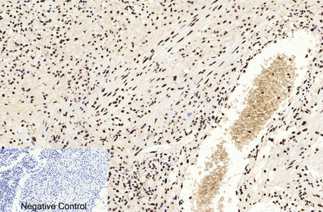 Immunohistochemistry of paraffin-embedded Human appendix tissue using Acetyl-Histone H3 (Lys9) Polyclonal Antibody at dilution of 1:200.