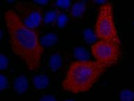 Immunofluorescence analysis of 293T cells transfected with a VSV G tagged protein tissue using VSV-G-Tag Monoclonal Antibody at dilution of 1:2000.