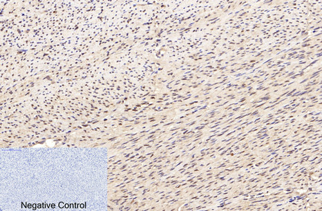 Immunohistochemistry of paraffin-embedded Human uterus tissue using Lamin B1 Monoclonal Antibody at dilution of 1:200.