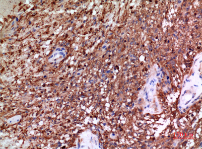 Immunohistochemistry of paraffin-embedded Human brain tissue using alpha Tubulin Polyclonal Antibody at dilution of 1:100.