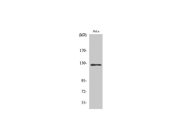 Western Blot analysis of Hela cells using SMG7 Polyclonal Antibody at dilution of 1：2000.