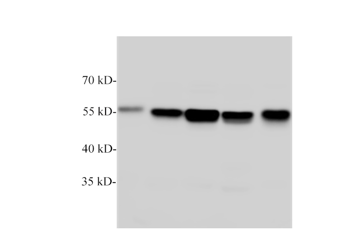 Western Blotting with anti-TUBB polyclonal antibody at dilution of 1:1000.
Lane 1:Hela, Lane 2: NIH/3T3, Lane 3: C6, Lane 4: PC-12, Lane 5: A431