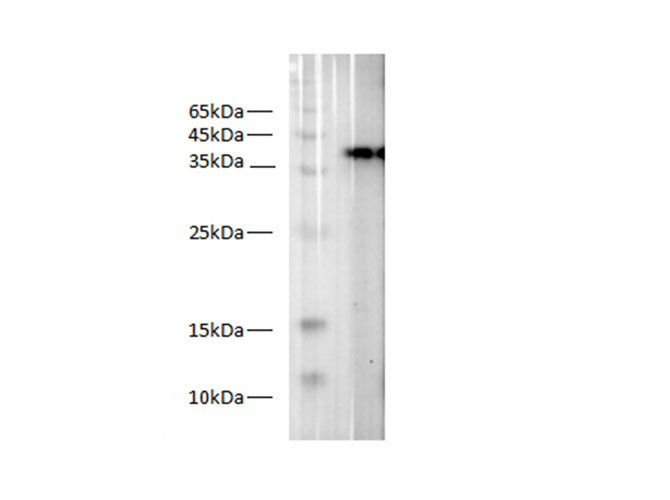 Western blot of S-Tag fusion protein with anti-S tag antibody at dilution of 1:2000.