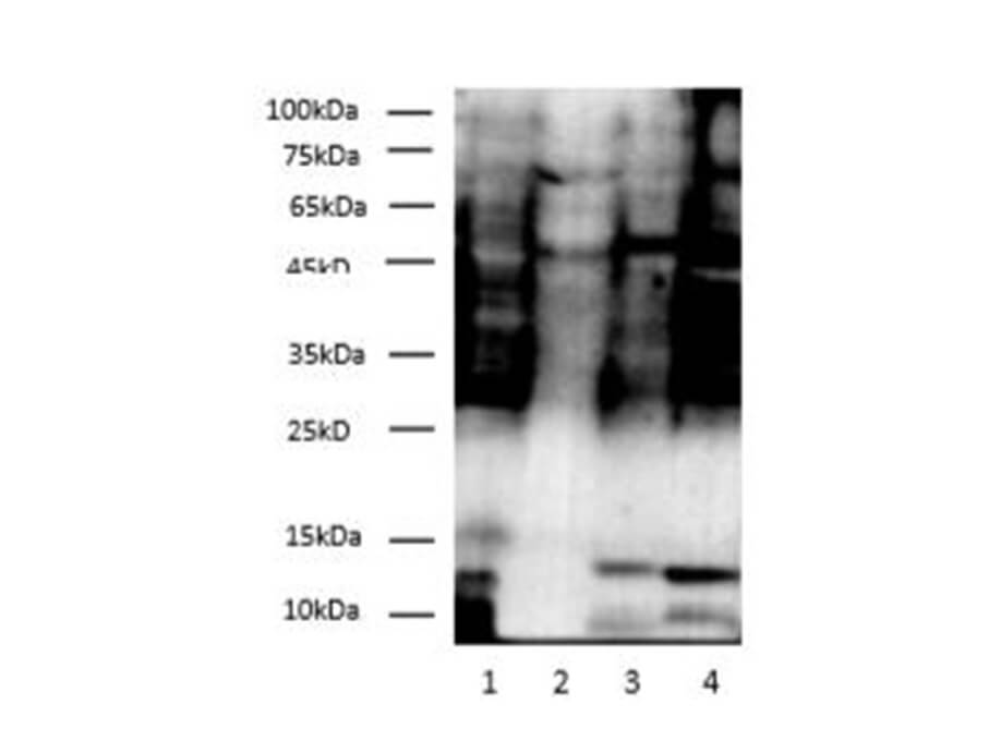 Western blotting of Dimethyl-Lysine polyclonal antibody at dilution of 1:500.
Lane 1: E.coli, Lane 2: Mouse Thymus, Lane 3: Mouse Brain, Lane 4: Hela cell lysates.