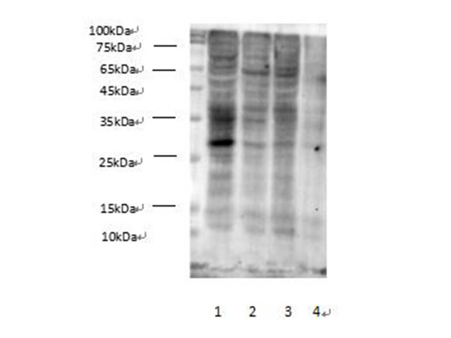 Western Blot analysis of Succinylated Lysine in various cell lines at dilution of 1:1000.
Lane 1 HEK-293, Lane 2 MCF7, Lane 3 HepG2, Lane 4 Hela cell lysates.