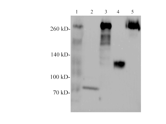 Western blotting with anti-Filamin-c polyclonal antibody at dilution of 1:500. Lane 1: Mouse skeletal muscle lysate, Lane 2: Mouse liver lysate (Negative), lane 3: Rat skeletal muscle lysate, Lane 4:Rat liver lysate (Negative),   Lane 5: Hela cell lysate.