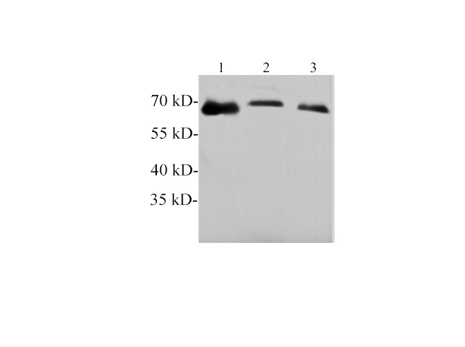 Western blotting with anti-Tyrosine hydroxylase polyclonal antibody at dilution of 1:1000. Lane 1: Mouse brain lysate, Lane 2: PC-12 cell lysate, lane 3: Rat brain lysate.