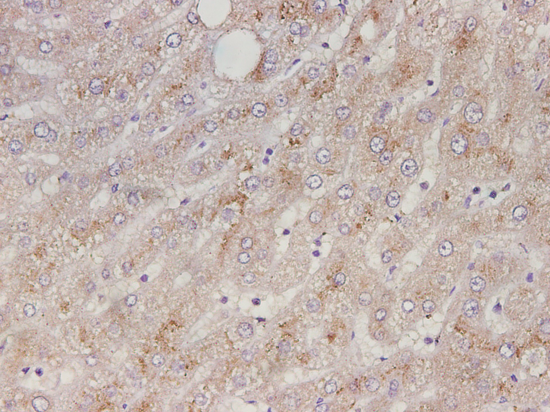 Immunohistochemistry of paraffin-embedded Human liver tissue using Serpin A1 Polyclonal Antibody at dilution of 1:3500(×400)