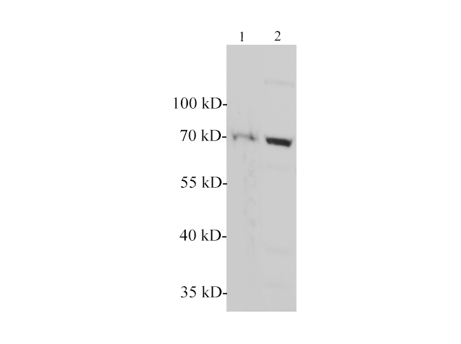 Western blotting with anti-NF2 polyclonal Antibody at dilution of 1:1000. Lane 1: Mouse brain lysates, lane 2: Rat brain lysate.