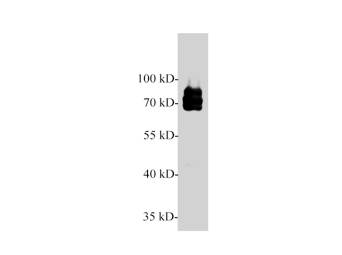 Western blot of PC-3 cell lysate with NF2 polyclonal antibody at 1:1000 dilution.