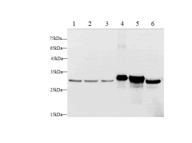 Western blot with Lgals3 Polyclonal antibody at dilution of 1:500.lane 1: Hela whole cell lysate, lane 2:MCF-7 whole cell lysate, lane 3:A431 whole cell lysate,lane 4：RAW264.7 whole cell lysate,lane 5:NIH/3T3 whole cell lysate,lane 6: C6 whole cell lysate