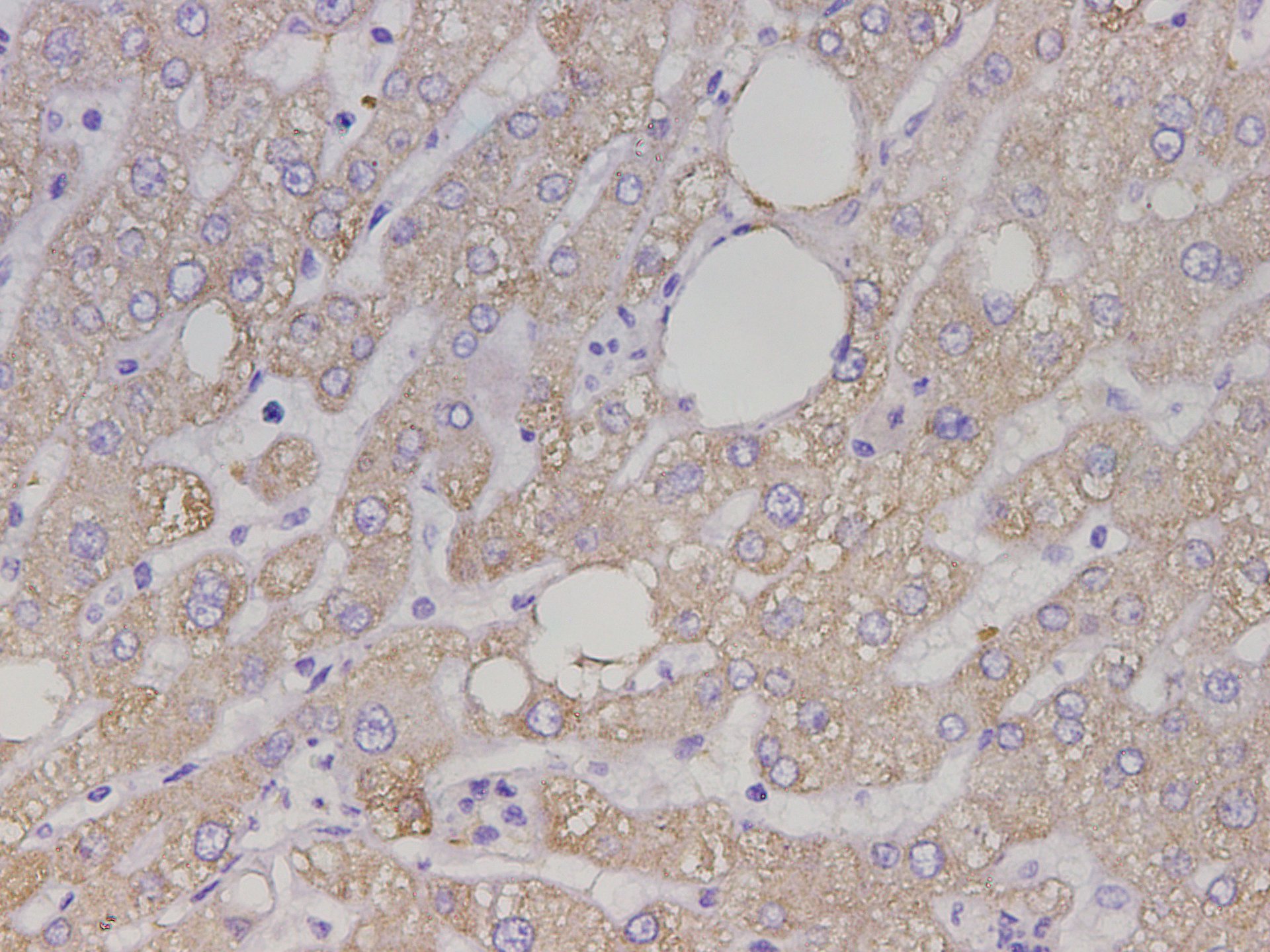 Immunohistochemistry of paraffin-embedded Human liver tissue using Maoa Polyclonal Antibody at dilution of 1:750(×400)