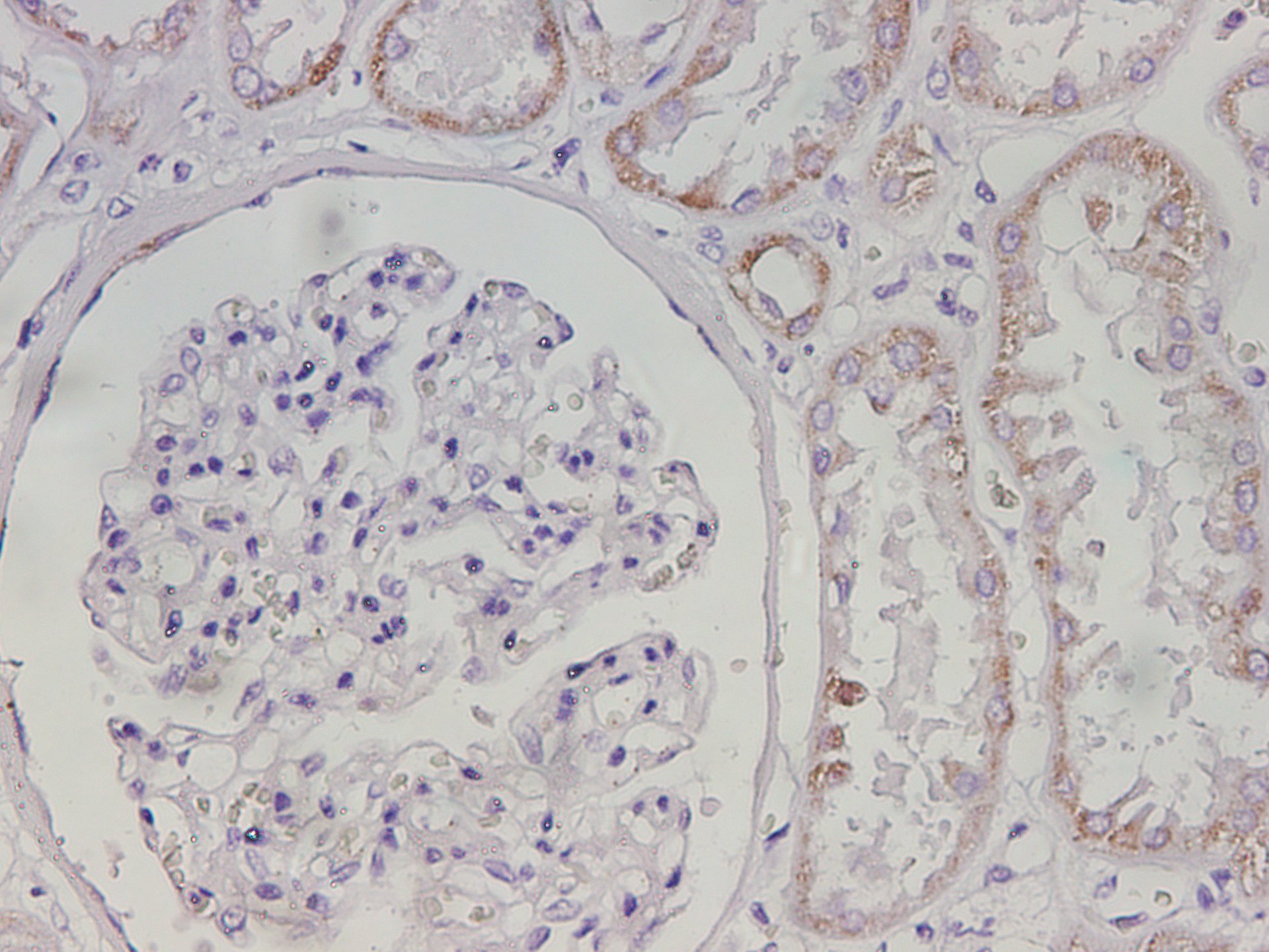 Immunohistochemistry of paraffin-embedded Human kidney tissue using Maoa Polyclonal Antibody at dilution of 1:250(×400)