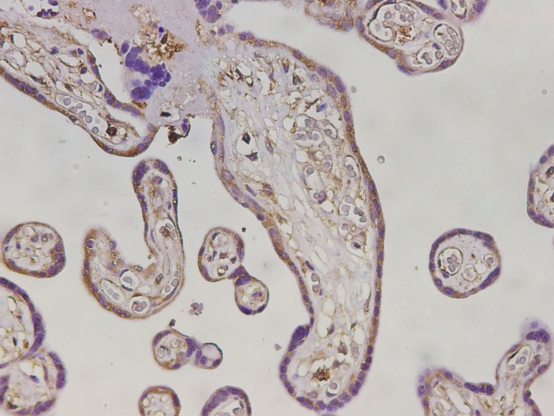 Immunohistochemistry of paraffin-embedded Human placenta tissue using MHCG Polyclonal Antibody at dilution of 1:3000(×400)