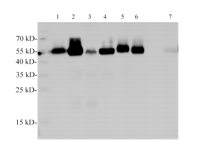 Western Blotting with anti-TUBA monoclonal antibody at dilution of 1:2000.
Lane 1: Hela cell lysates, Lane 2:jurkat cell lysates, Lane, 3: 293T lysates, Lane 4: MCF-7 cell lysates, Lane 5: HT-29 cell lysates, Lane 6:HepG2 cell lysates, Lane 7:Rat kidney lysates