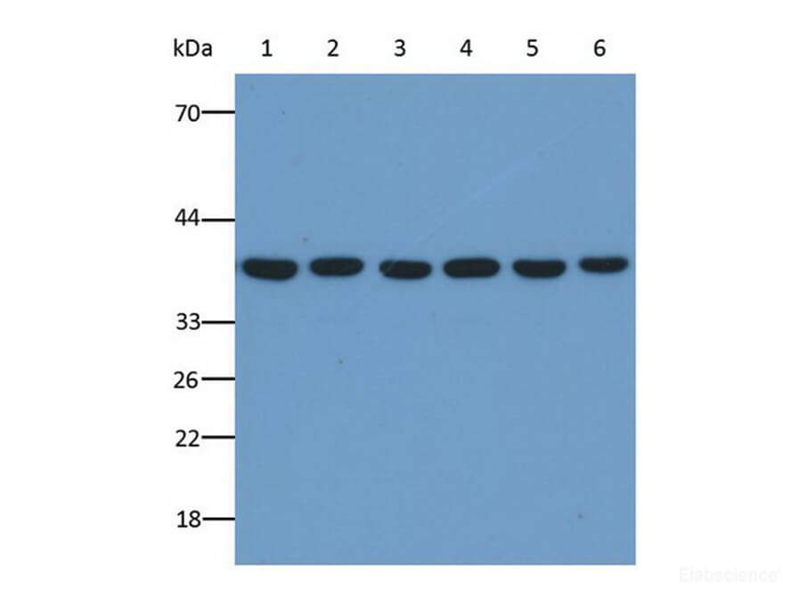 Western Blot analysis of GAPDH in various cell lines at dilution of 1:5000.
Lane1: DU145 whole cell lysate, Lane2: OS-RC-2 whole cell lysate, Lane3:T-47D whole cell Lysates, Lane4: HEC-1B whole cell lysate, Lane5: HepG2 whole cell lysate, Lane6: HEK-293 whole cell lysate,. Lysates/proteins at 20g per lane.