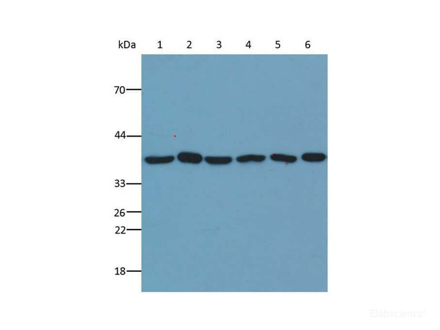 Western blot analysis of GAPDH in various tissues of different species at dilution of 1:5000.
Lane1 : Rat heart, whole tissue lysate, Lane2: Porcine brain, whole tissue lysate, Lane3: Bovine kidney, whole tissue lysate, Lane4: Guinea pig liver, whole tissue lysate, Lane5: Rabbit pancreas, whole tissue ysate, Lane6: Caprine spleen, whole tissue lysate.
Lysates/proteins at 20g per lane.