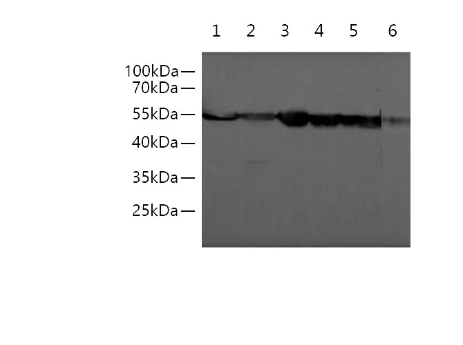 Western blotting with anti-Beta Tubulin monoclonal antibody at dilution of 1:5000.
Lane 1: Hela cell lysates, Lane 2: Caco-2 cell lysates, Lane 3: HT-29 cell lysates, Lane 4: NIH/3T3 cell lysates, Lane 5:Raw264.7 cell lysates, Lane 6: Rat liver