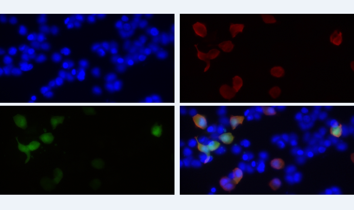 Immunofluorescent analysis of 293F cells transfected with HA-Tag fusion protein using anti-HA-Tag monoclonal antibody at dilution of 1:800.