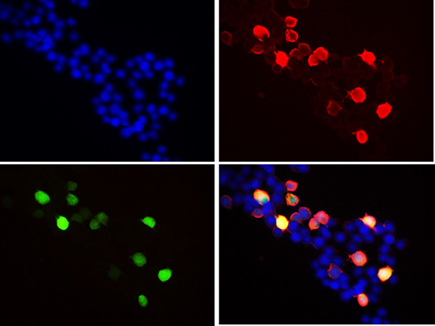 Immunofluorescent analysis of 293F cells transfected with the FLAG-GFP, using anti-Flag-Tag Monoclonal Antibody at 1:2000 dilution.