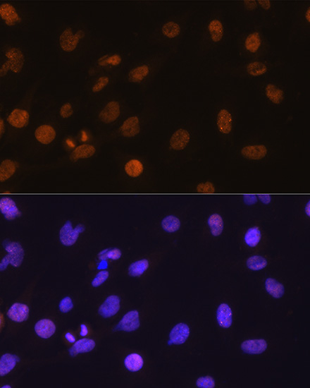 Immunofluorescence analysis of C6 cells using DDIT3/CHOP Polyclonal antibody at dilution of 1:100. Blue: DAPI for nuclear staining.