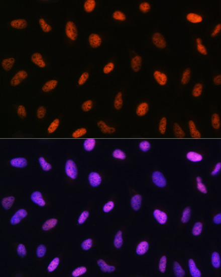 Immunofluorescence analysis of U2OS cells using DDIT3/CHOP Polyclonal antibody at dilution of 1:100. Blue: DAPI for nuclear staining.