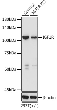 Western blot analysis of extracts from normal (control) and IGF1R knockout (KO) 293T cells using IGF1R Polyclonal Antibody at 1:3000 dilution.