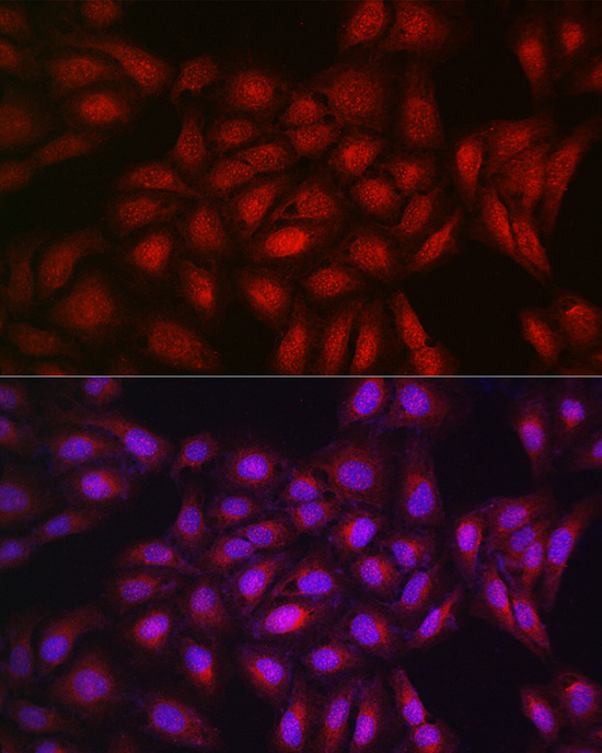 Immunofluorescence analysis of U2OS cells using PPARγ Polyclonal antibody at dilution of 1:200 (40x lens). Blue: DAPI for nuclear staining.